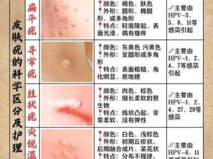 夫妻之间一晚上打几针hpv,夫妻之间一晚打几针 HPV？