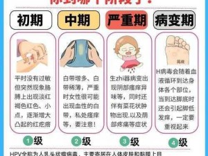 女生经常自己安慰会得hpv(女生经常自己安慰会得 HPV 吗？)